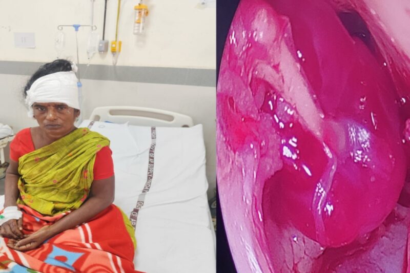 Vizianagaram:జీజీహెచ్ లో అరుదైన శస్త్ర చికిత్స